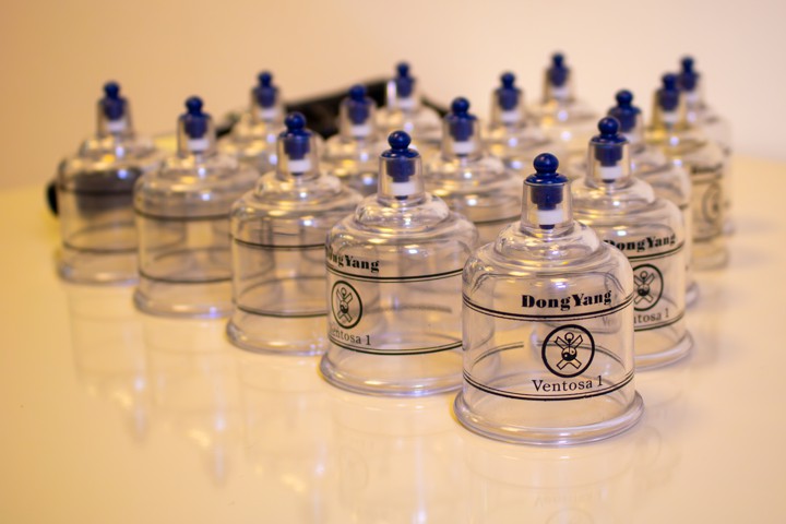 Foto 13 ventosoterapia.jpg